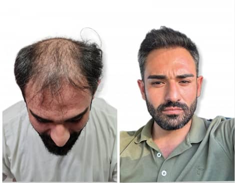 Slider image (9) Dali Hair Clinic